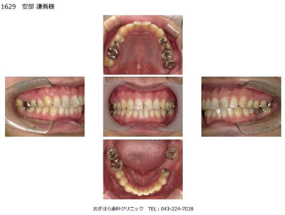 CT撮影・口腔内写真の撮影