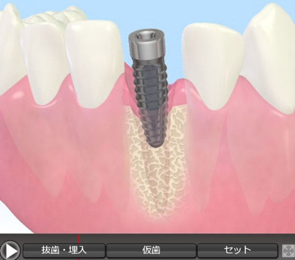 ノーベルバイオケア