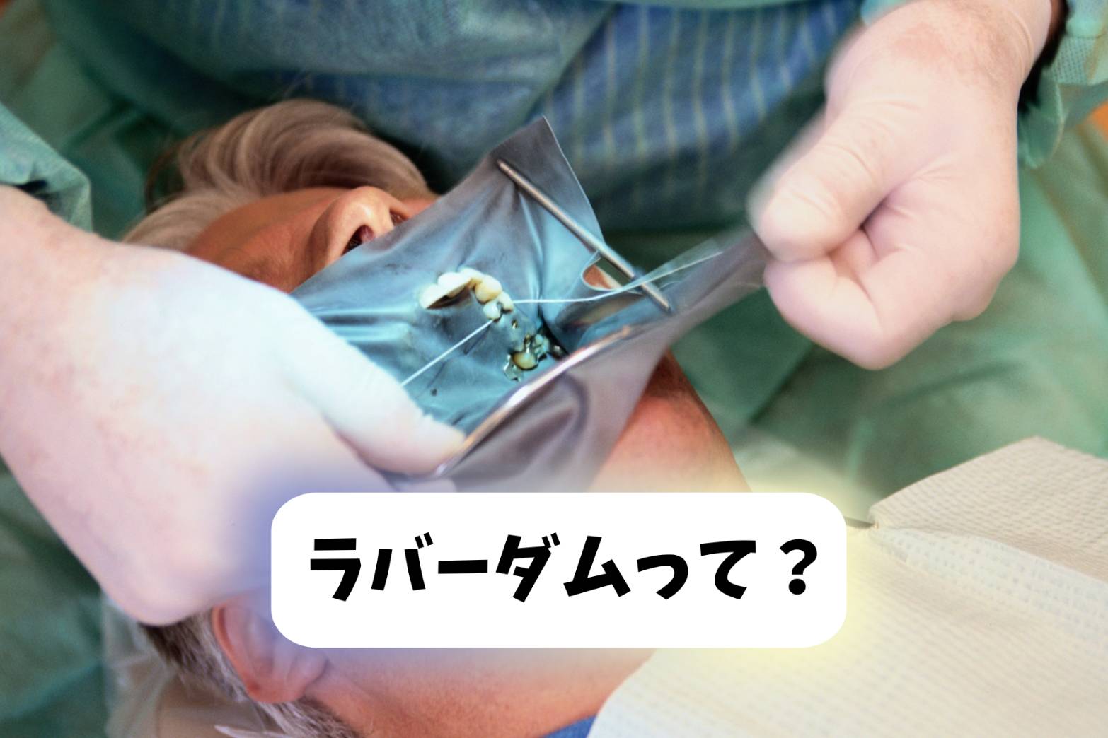 ラバーダムについて