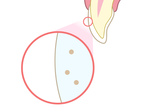 歯が白く美しく変身!